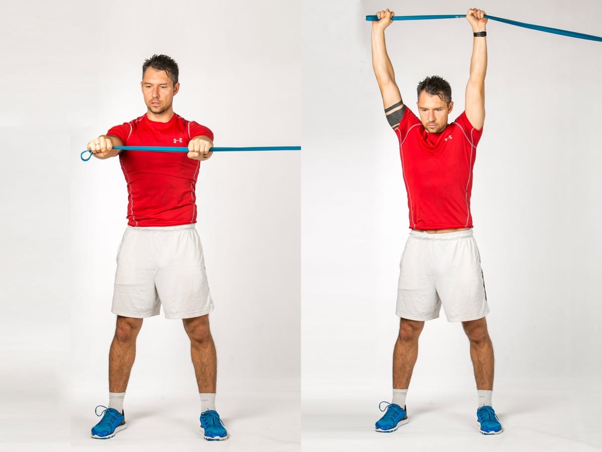 Band Anti-Rotation Lift